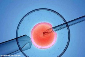 代生试管机构